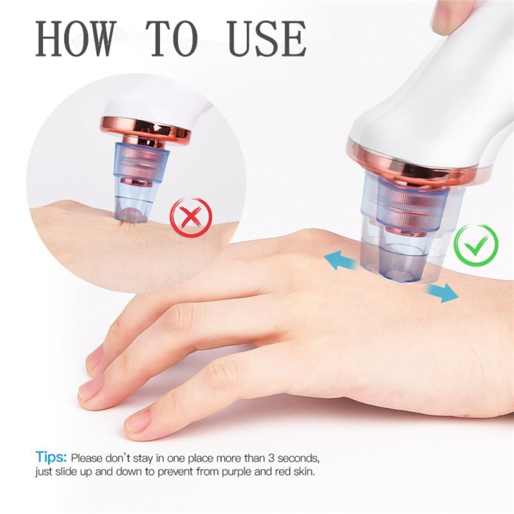 Electric Vacuum Blackhead Remover Device